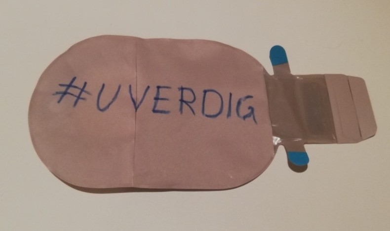 Helfo viderefører uverdige begrensninger på medisinsk utstyr